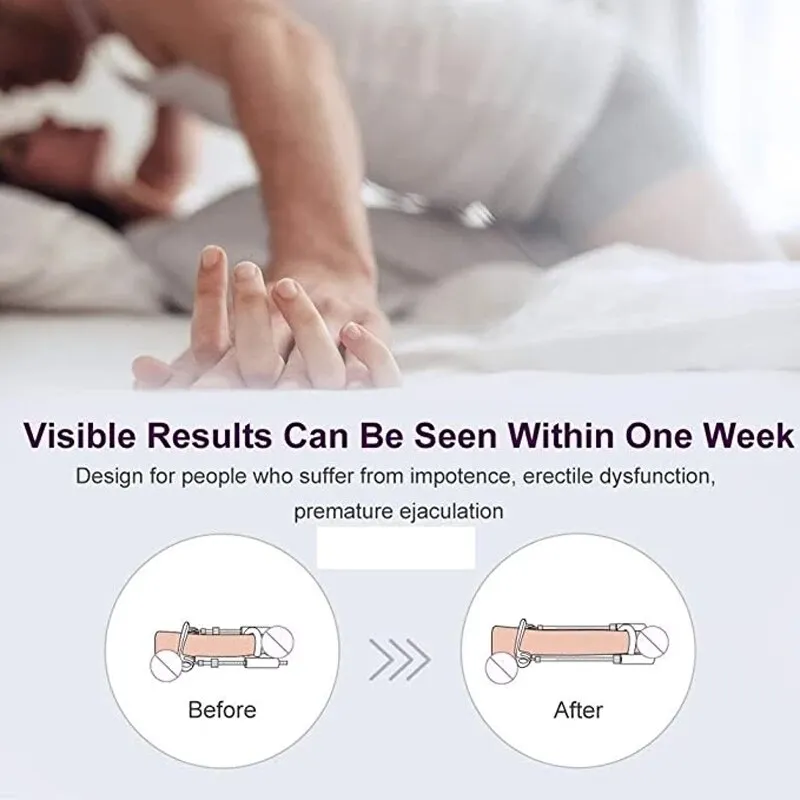 Penile Enlargement Kit