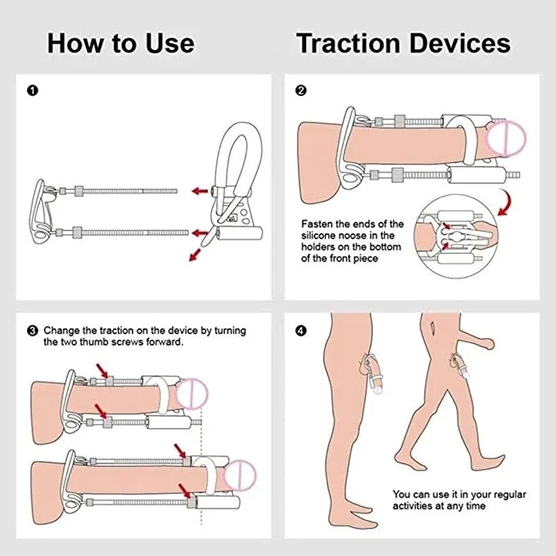 Penile Enlargement Kit